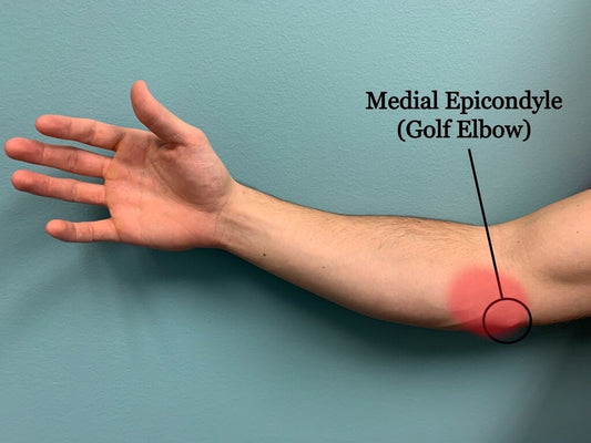 golf elbow (medical epicondyle)